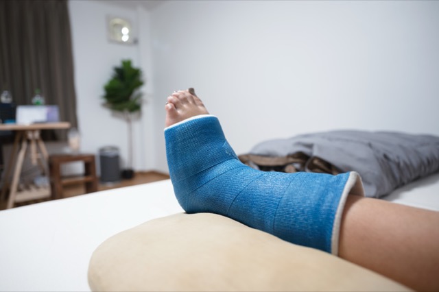 woman-accident-with-bone-fracture-foot-in-plaster-2025-03-24-08-16-38-utc.jpg